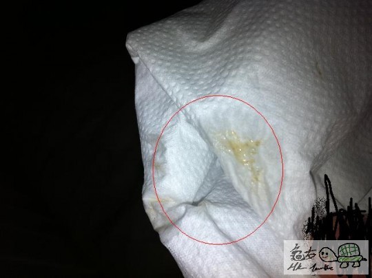 同埋佢痾之前個PAT 有小小綠色液體.呢D係咩黎???