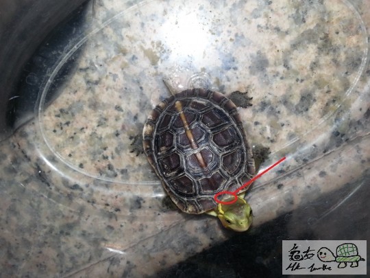 頸