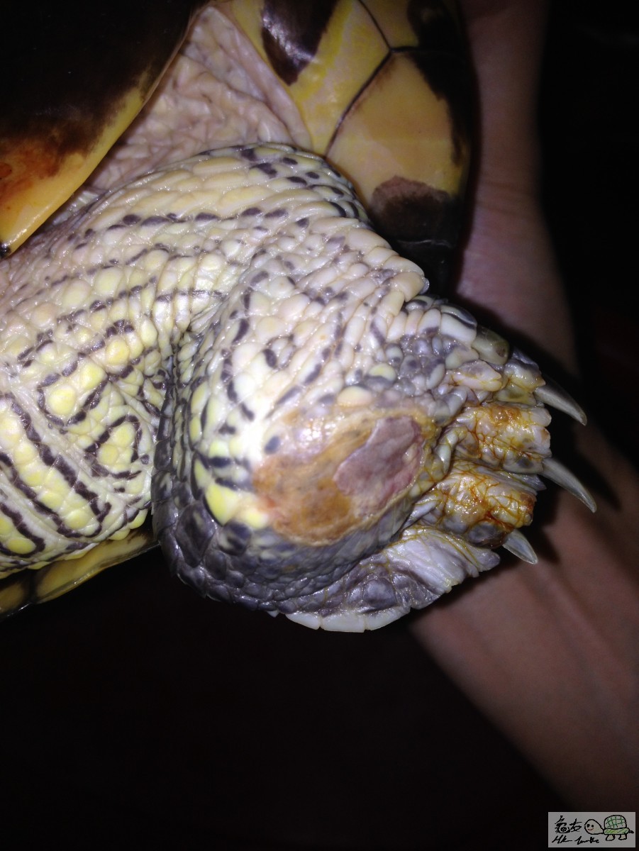 比較嚴重GE龜 左腳