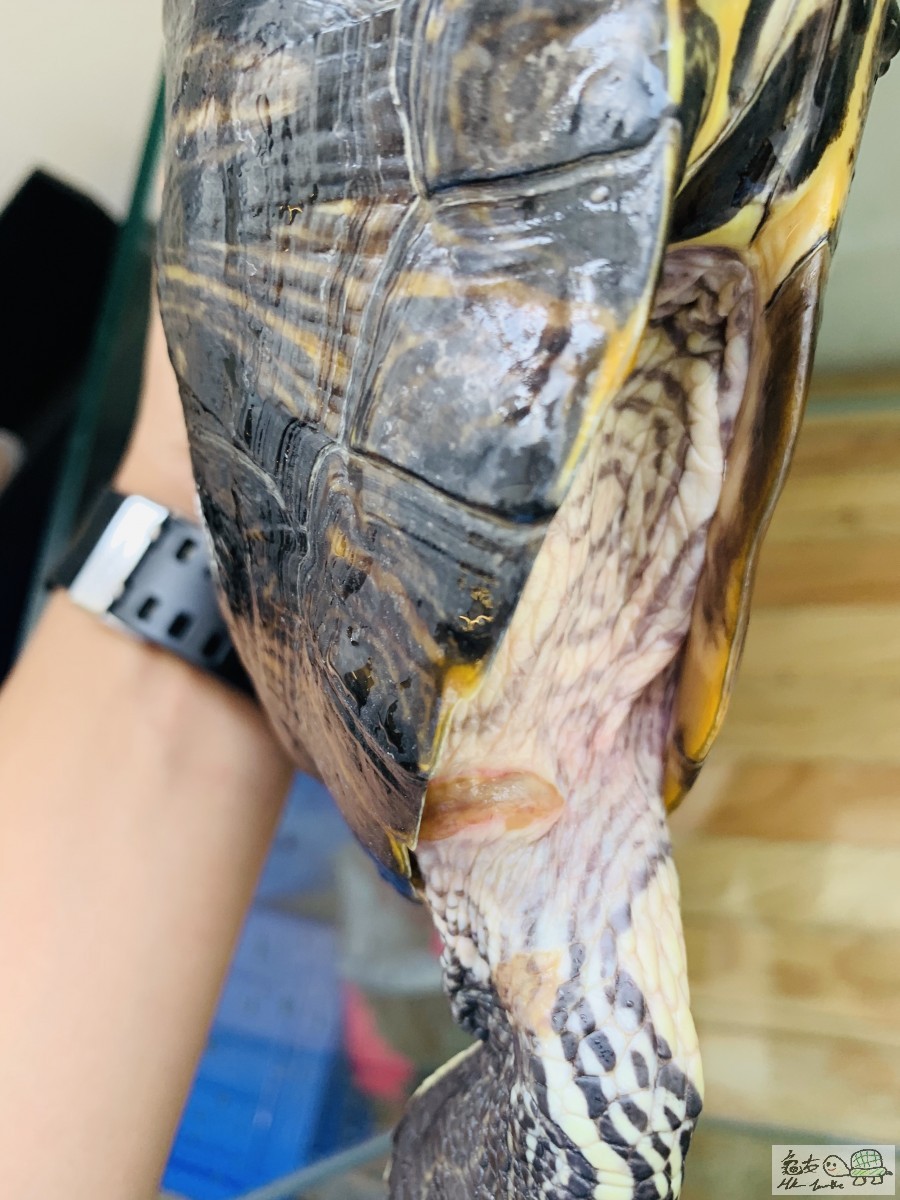 搽左4日聚維珂碘